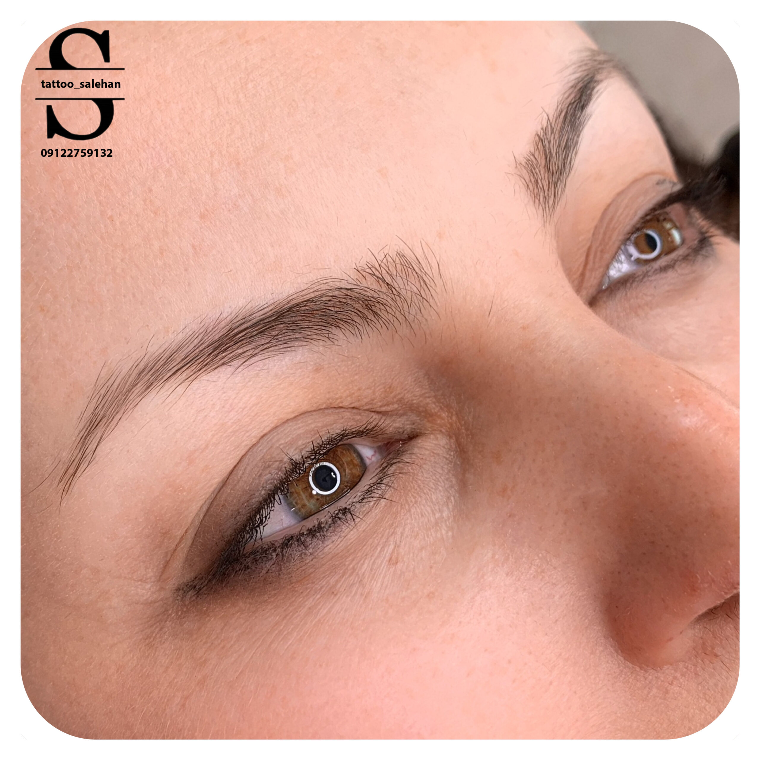 میکروبلیدینگ طبیعی